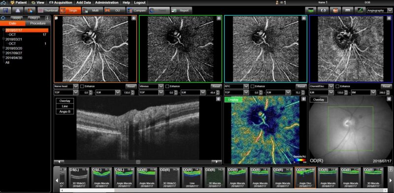 maestro2 screenshot Angio