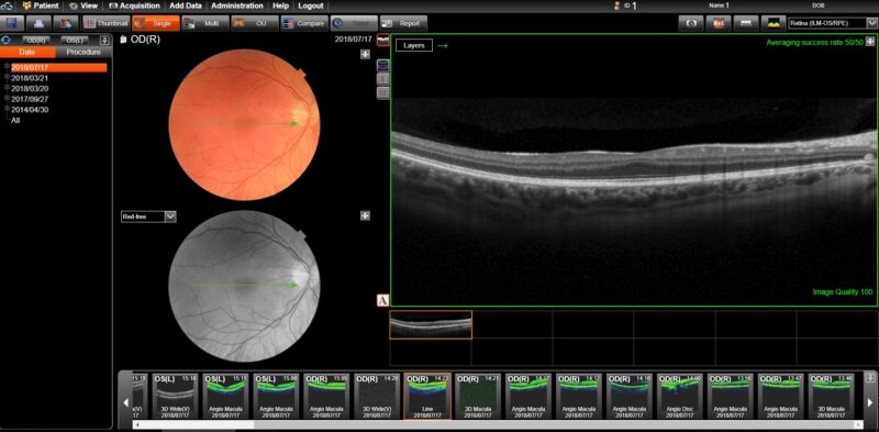 maestro2 screenshot B sccan