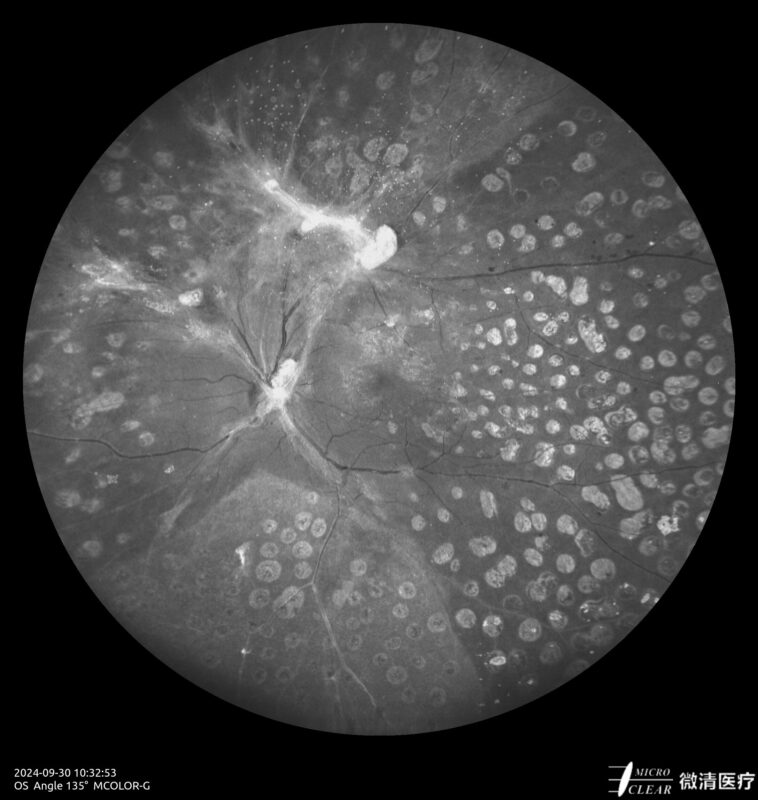 2024_09_30_10_32_55_752_MCOLOR_G- Carroussel 13