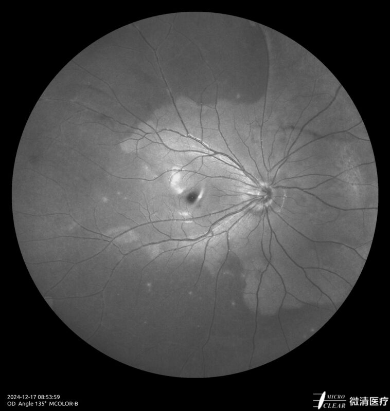 2024_12_17_08_54_00_861_MCOLOR_B- Carroussel 6