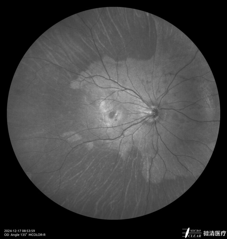 2024_12_17_08_54_00_861_MCOLOR_R Carroussel 7