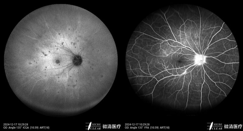 2024_12_17_10_29_28_355_ART(18-18)_ICGA-FFA- Carroussel 8