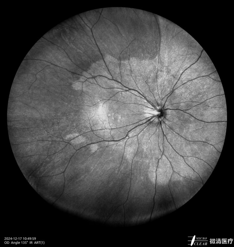 2024_12_17_10_49_59_587_ART(1)_IR - Carroussel 19