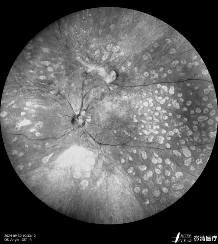 fundus Carroussel 10